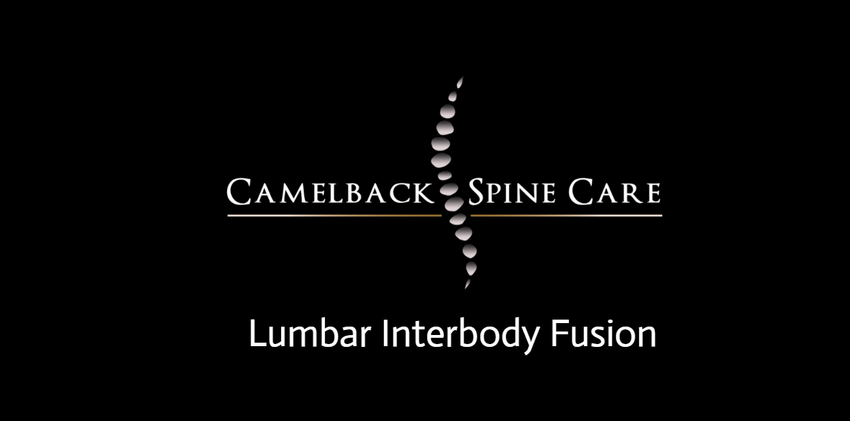 Lumber Interbody Fusion